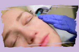 jak usunąć sińce pod oczami