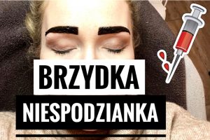 brzydka niespodzianka na mikołajki - 2